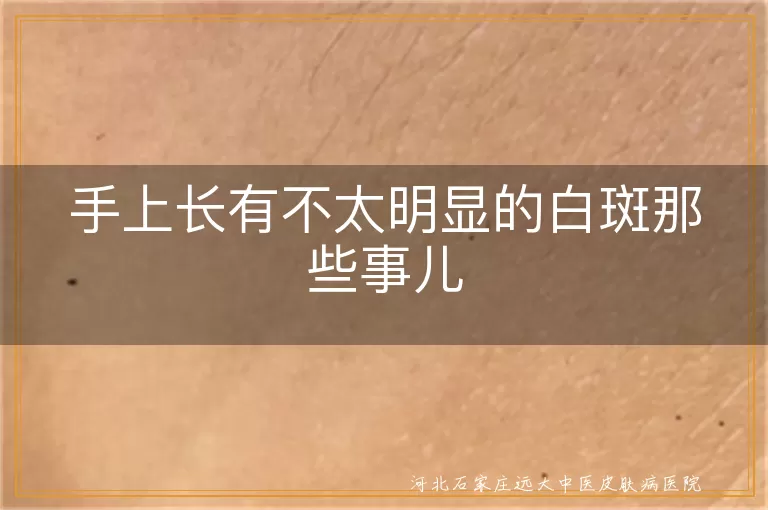 手上白癜风初期症状,白斑可能原因,白癜风日常护理,白斑心态调整