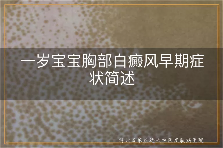 一岁宝宝胸部白癜风症状,白癜风早期白斑表现,儿童白癜风免疫力变化,婴幼儿白斑识别方法