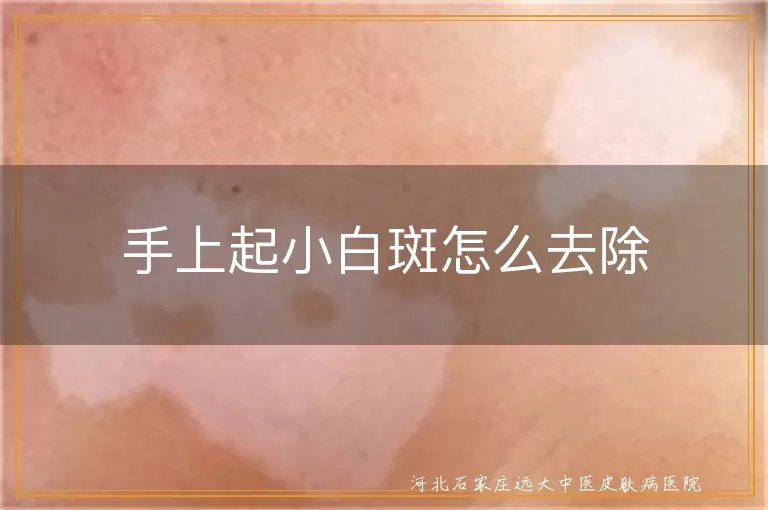 白癜风治疗手上白斑, 白斑去除方法, 手部白斑治疗, 手上白斑怎么办