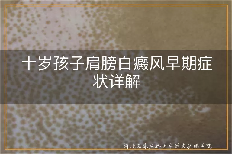 十岁儿童肩膀白癜风症状,白癜风早期白斑特点,儿童白癜风皮肤感觉变化,肩膀白癜风初期表现
