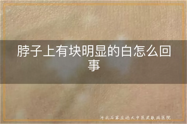 脖子上白斑原因,白癜风症状分析,颈部白斑预防方法,白斑疾病种类介绍