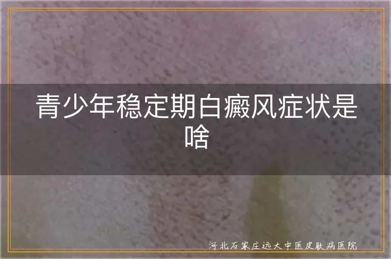 青少年白癜风稳定期表现,白斑停止扩散特点,白癜风稳定期边缘清晰,青少年白斑心理影响