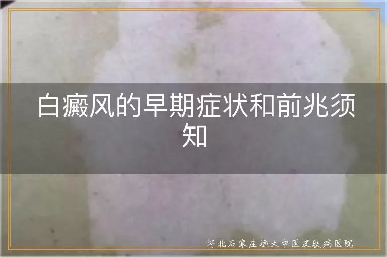 白癜风早期皮肤变化,白癜风特定部位色素减退,白癜风皮肤感觉异样,白癜风指甲毛发变化