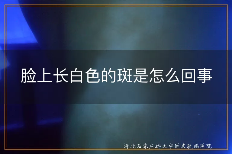 脸上白斑原因,白癜风症状与治疗,白斑治疗方法,白斑日常护理