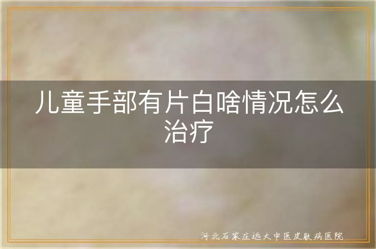 儿童手部白斑原因与治疗,孩子手上白癜风怎么办,儿童手部白斑治疗方法,小孩手上白斑咋回事