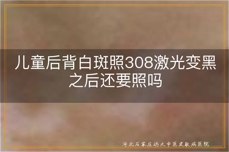 儿童白斑激光治疗继续,白癜风激光变黑后处理,儿童白癜风激光治疗周期,白斑变黑后是否继续治疗