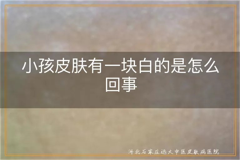 小孩皮肤白斑原因,小孩皮肤白癜风,小孩皮肤白块识别,小孩皮肤白块处理
