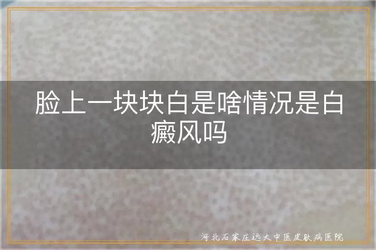 脸上白斑是白癜风症状吗,白癜风如何判断与治疗,如何预防白癜风发生