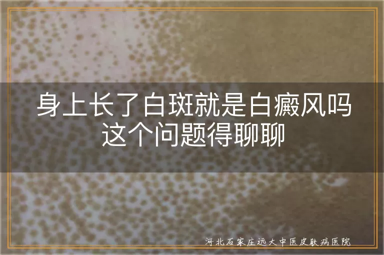 白斑可能是哪些原因,白癜风如何诊断,白癜风治疗与心态