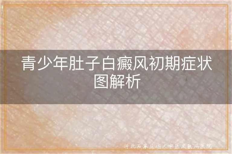 青少年白癜风初期症状,肚子白斑图解,白斑识别与应对
