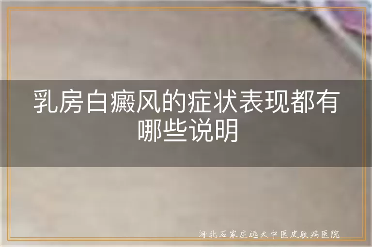 乳房白癜风白斑症状,乳房皮肤感觉异常,白癜风病情反复表现