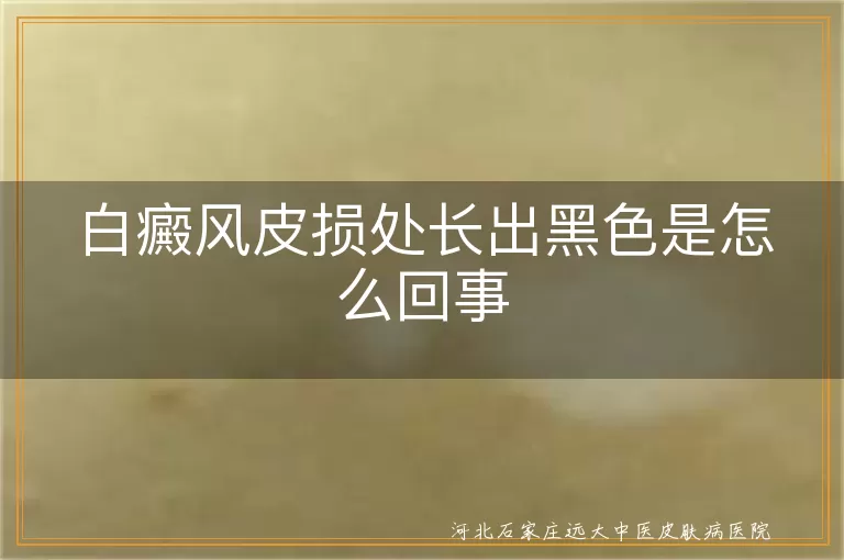 白癜风白斑长出黑色原因,白斑变黑是好转吗,白癜风治疗与预防