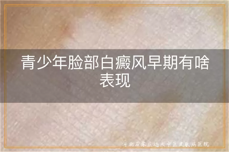 青少年脸部白癜风早期症状,白癜风皮肤感觉异常,青少年白癜风情绪影响