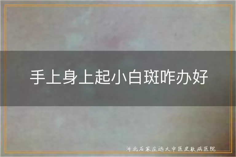 手上白斑怎么办,白癜风治疗方法,身上白斑护理