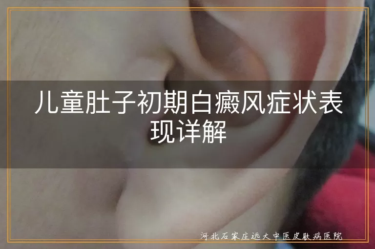 儿童肚子白癜风初期症状,白斑颜色与边缘变化,白斑扩散与伴随症状
