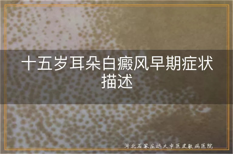 十五岁耳朵白癜风初期表现,青少年耳朵白斑症状,耳朵白癜风早期图样