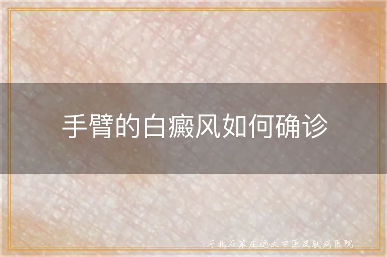 手臂白癜风确诊方法, 白癜风白斑检查流程, 皮肤白斑诊断步骤