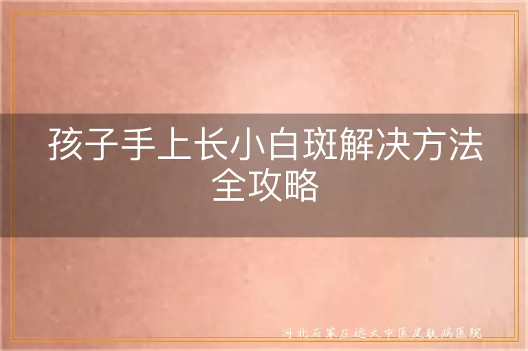孩子手上白癜风如何祛除,儿童白斑治疗方法,小孩手上白斑怎么消除