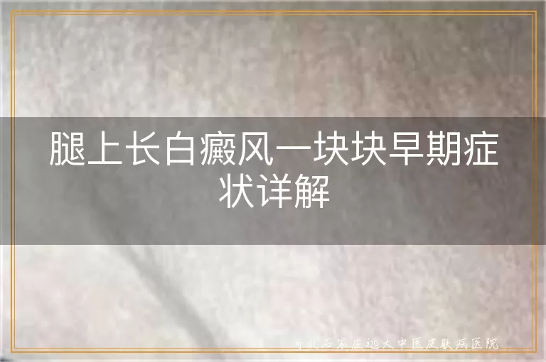 腿上白癜风早期表现,白斑扩散症状,白癜风皮肤感觉