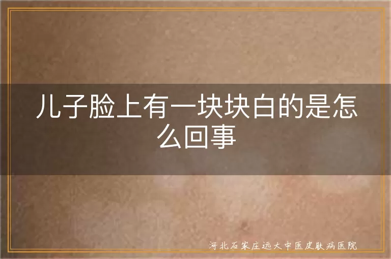 儿子脸上白斑怎么回事,孩子脸上白癜风原因,小孩脸上白块如何处理