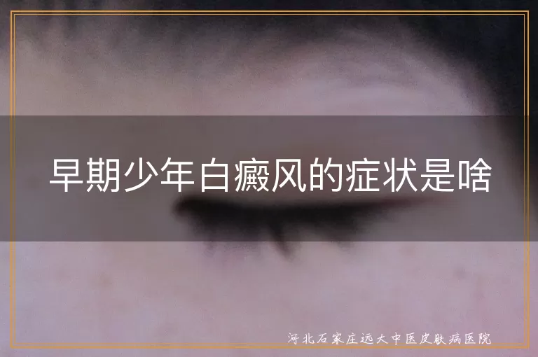 少年白癜风初期症状,白斑边缘清晰度,白斑皮肤敏感性