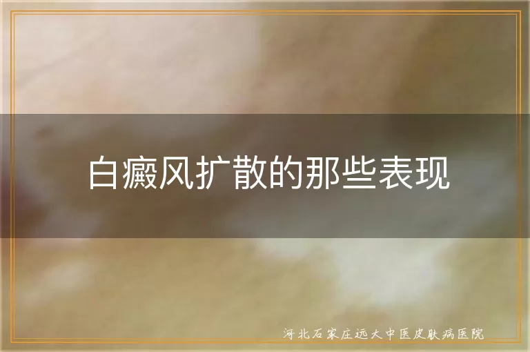 白癜风扩散症状,白斑面积变化,白斑颜色加深