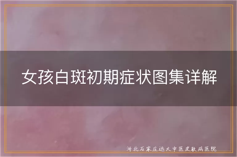 女孩白癜风初期症状,白斑初期图片展示,女性白斑治疗与心态调整