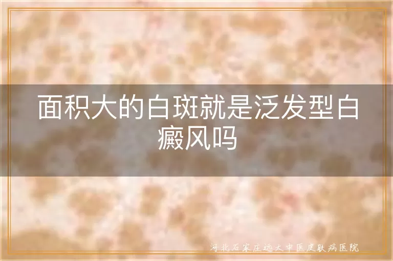 大面积白斑与白癜风关系,白斑成因及类型,白癜风诊断与治疗