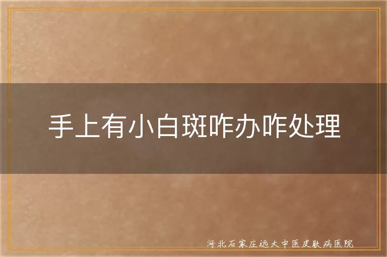 手上白癜风咋处理,白斑日常护理方法,白癜风治疗耐心