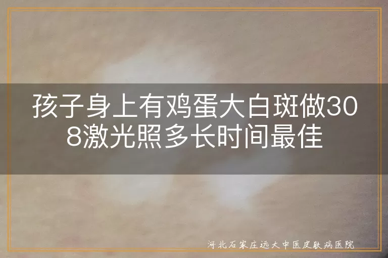 孩子白癜风治疗时长,白斑308激光照射时间,儿童白斑最佳治疗方案