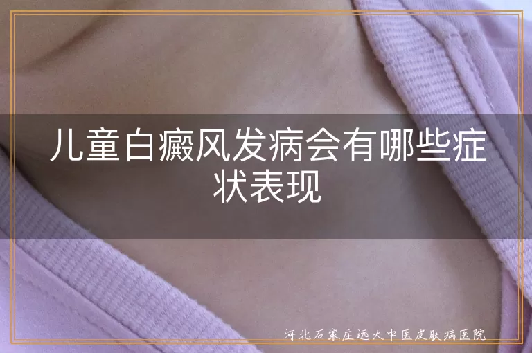 儿童白癜风症状,白斑边缘变化,伴随自身免疫疾病