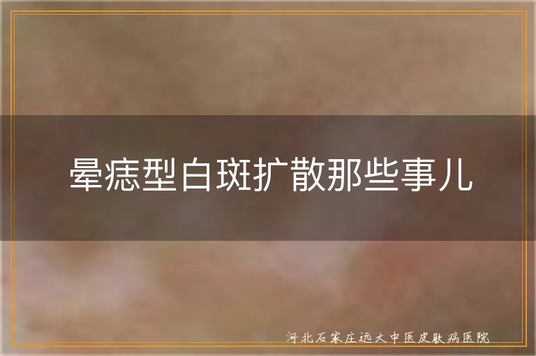 晕痣型白斑症状图,白癜风扩散原因,白斑治疗方法