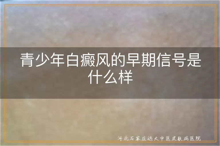 青少年白癜风早期表现,白斑边缘清晰症状,毛发变白与白癜风