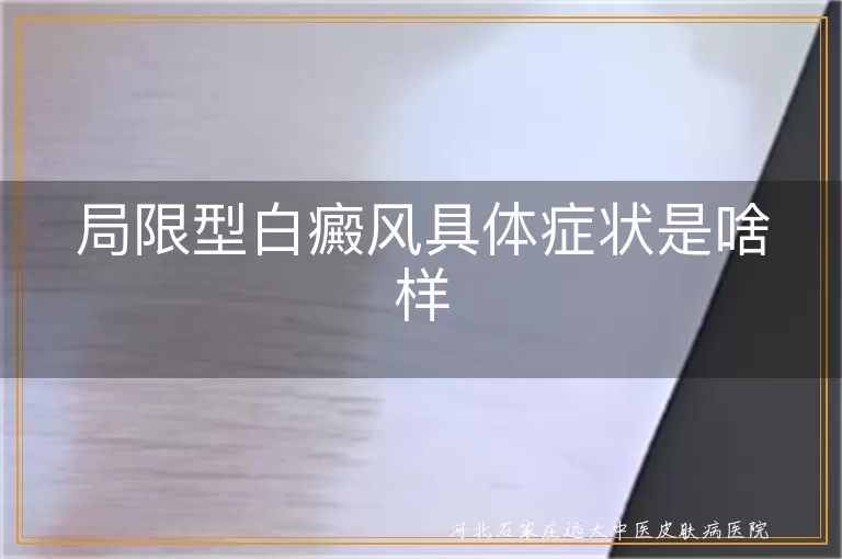 局限型白癜风具体症状是啥样
