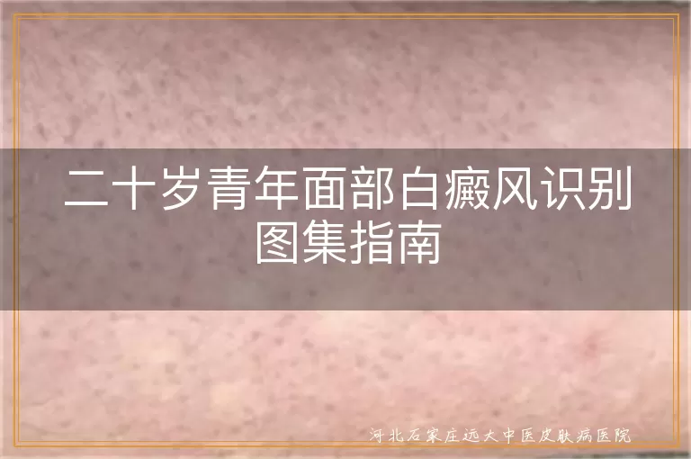 二十岁青年面部白癜风症状,面部白斑识别技巧,白癜风早期图片