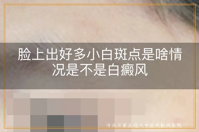 脸上小白斑点与白癜风关系,白斑可能的病因,白癜风诊断方法
