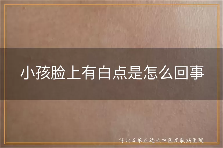 小孩脸上白斑原因多,白癜风小孩脸上白点咋处理,小孩脸上白点需警惕