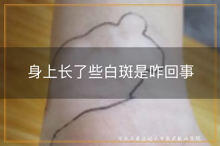 身上长了些白斑是咋回事