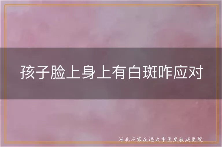 孩子脸上身上有白斑咋应对