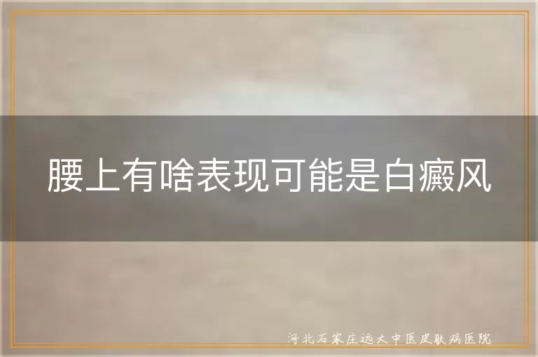 腰上白癜风症状,白斑变化特点,白癜风治疗方法