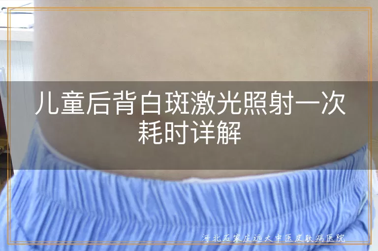 儿童白癜风激光治疗时间,白斑激光治疗一次多久,儿童后背白斑治疗周期