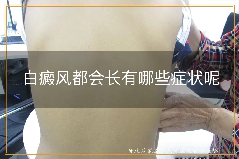 白癜风典型皮肤白斑特征,白癜风毛发变白表现,白癜风病情发展伴随症状