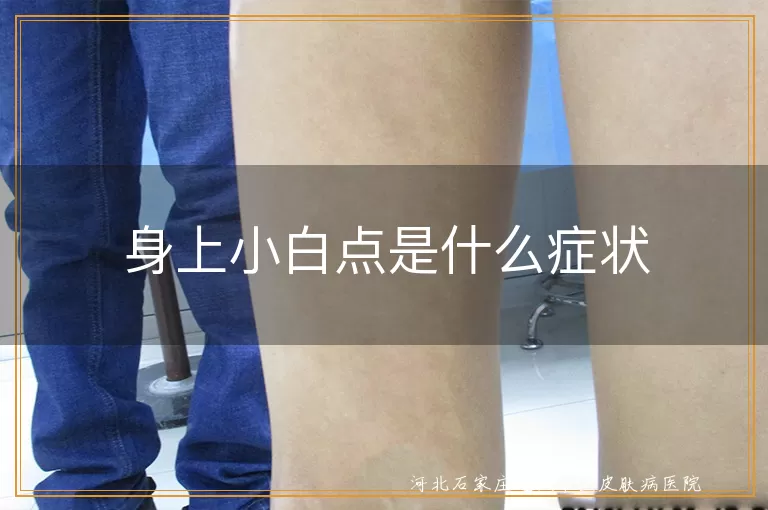 白癜风早期皮肤白点症状,白斑病初期小白点表现,白癜风初期小白点特征