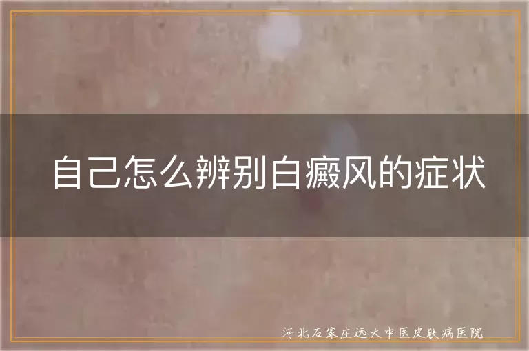 白癜风自我筛查小方法,白斑初期自查技巧,如何识别白癜风信号