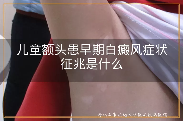 早期额头白斑征兆,儿童白癜风初期表现,白斑症状孩子额头