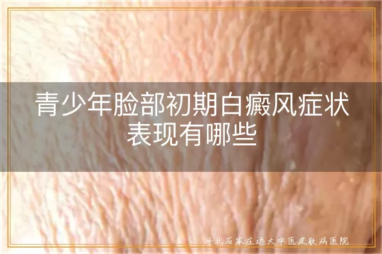 青少年脸部初期白癜风症状表现有哪些