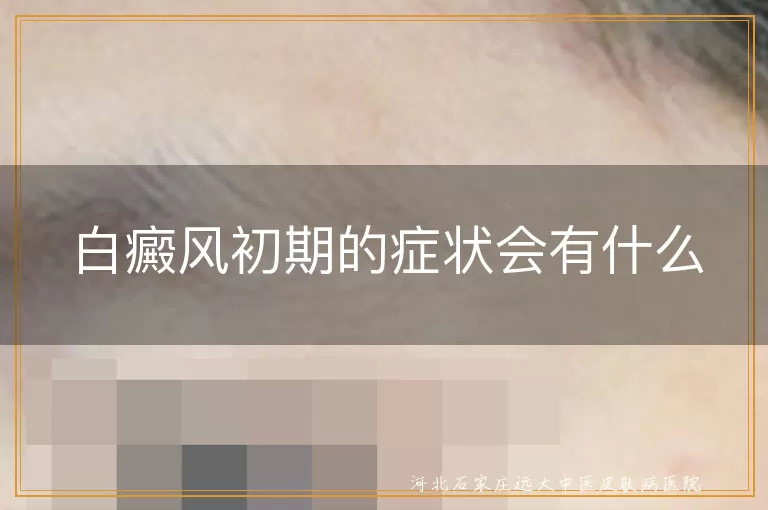 认识白癜风早期表现,白斑初现要警觉,白癜风症状全记录