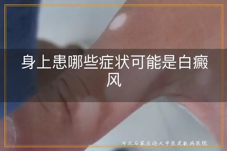 白癜风早期白斑症状自查,皮肤出现白斑需警惕白癜风,白斑扩散迹象与白癜风关系