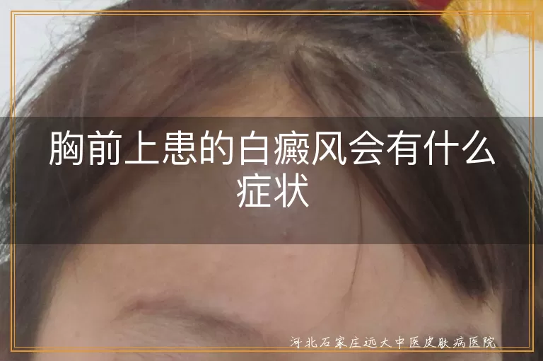 胸前上患的白癜风会有什么症状