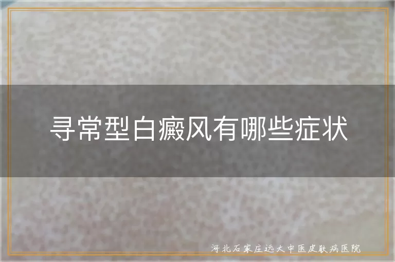 寻常型白癜风有哪些症状